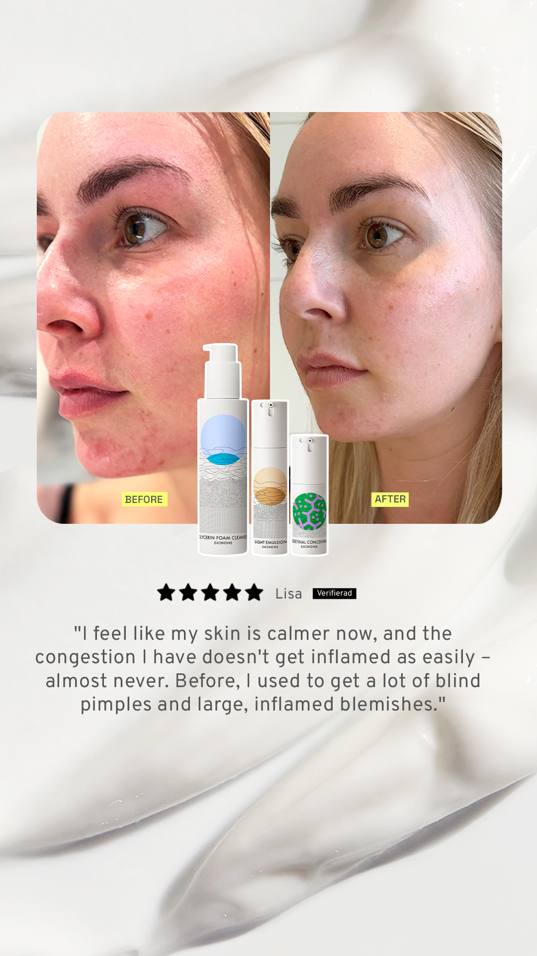 Skinome Facebook ad