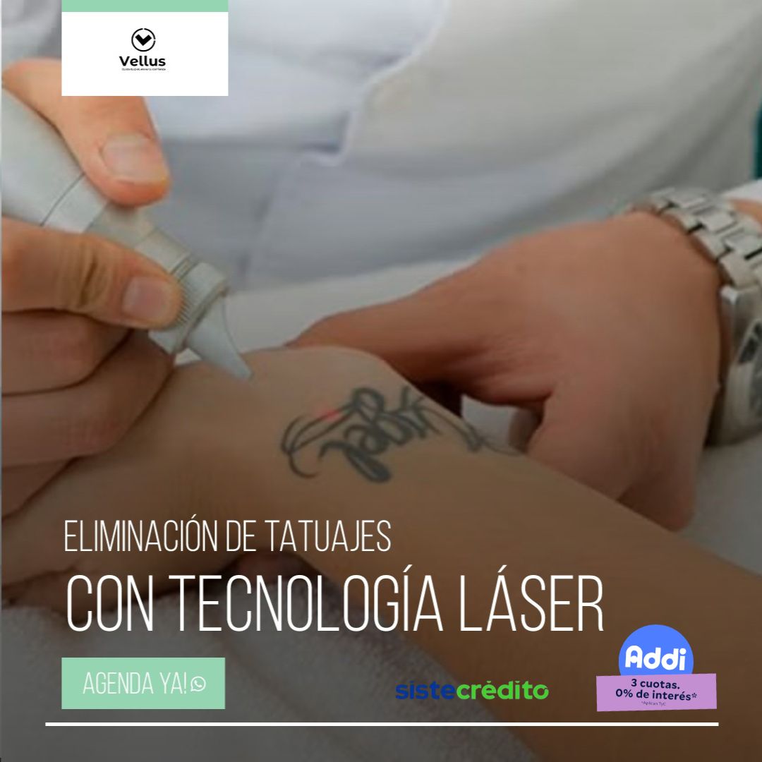Vellus Facebook ad: Chatea con nosotros