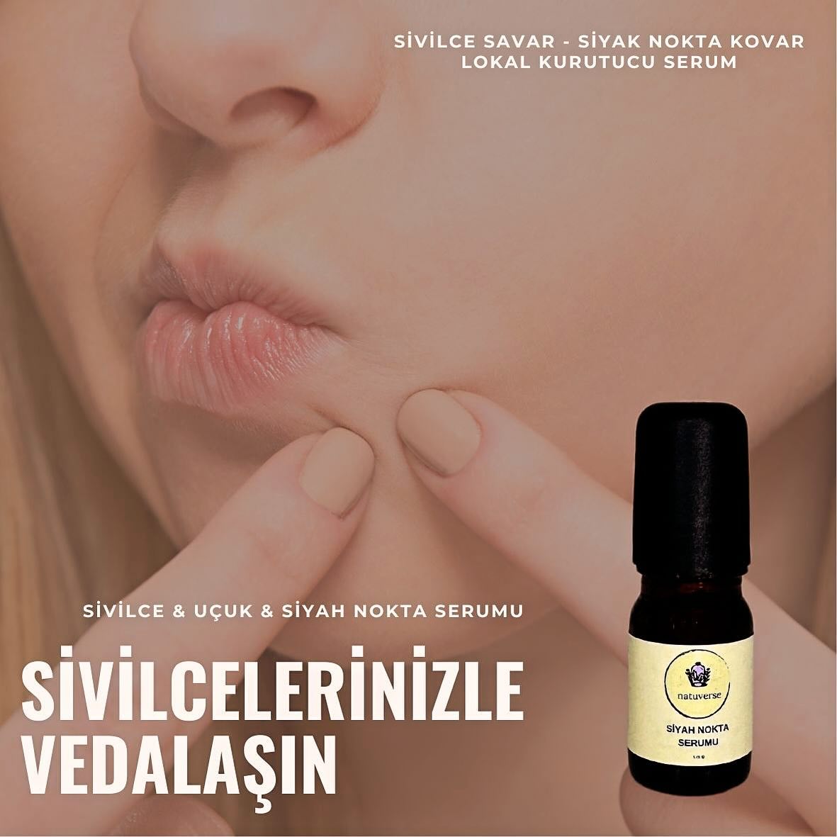 natuversedogalkozmetik Facebook ad: Cildinizin yaptığı sivilce, uçuk gibi kötü sürprizlerle…