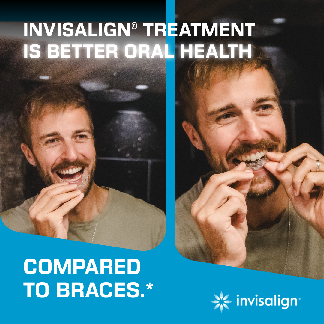 Invisalign UK & Ireland Facebook ad