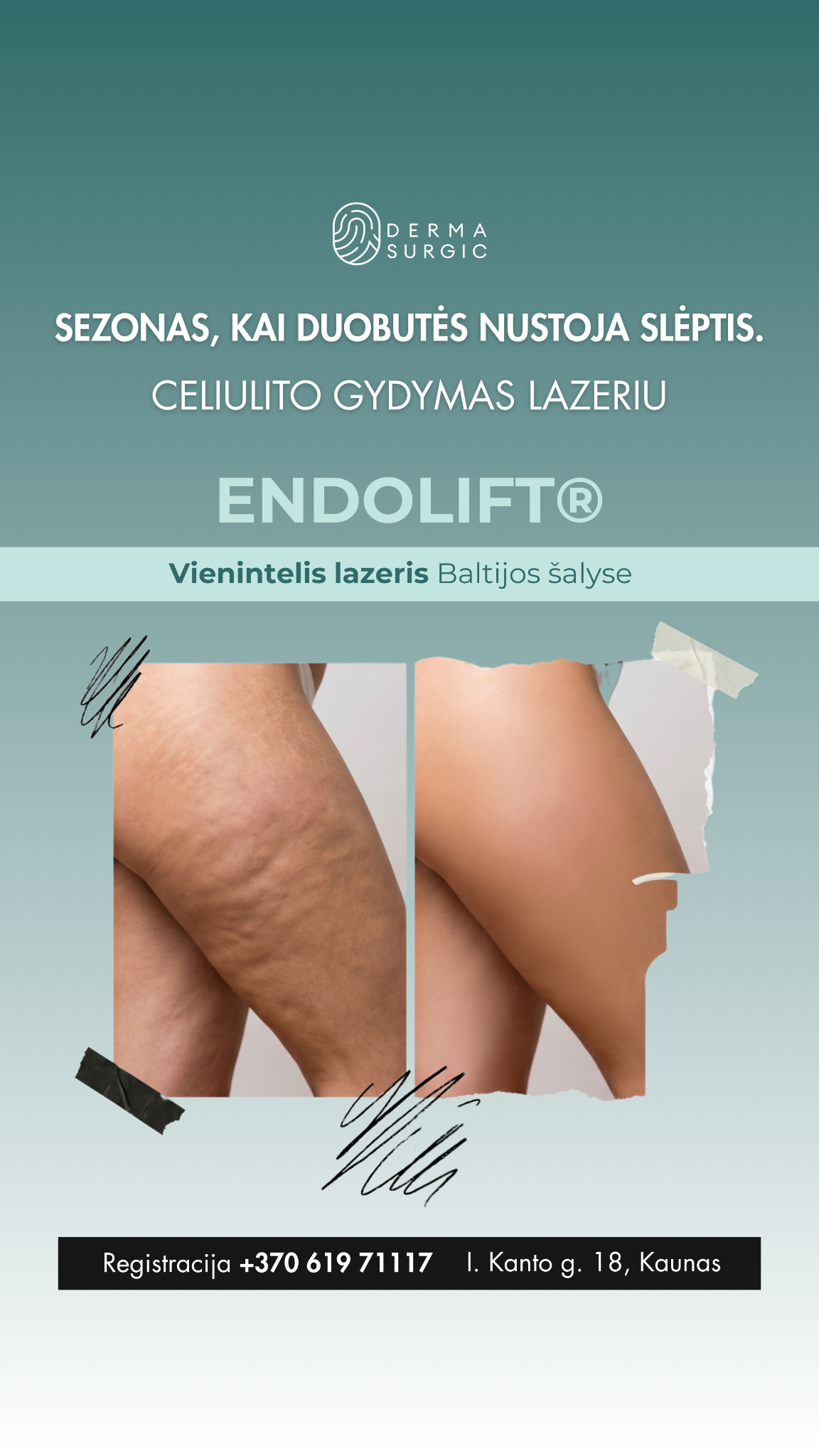 DermaSurgic estetinės medicinos ir chirurgijos centras Facebook ad