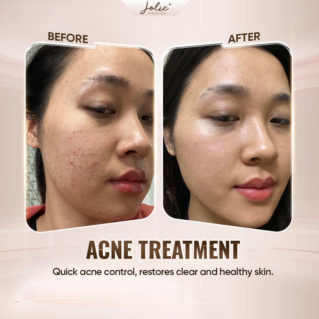 Jolie Clinic Facebook ad