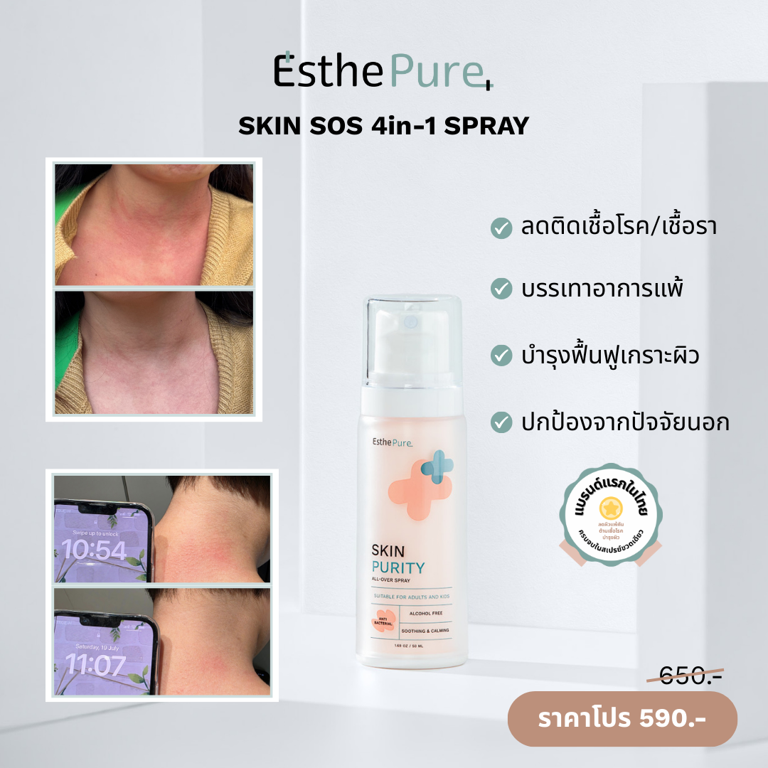 Esthepure.Official Facebook ad: คับยุบยิบน่ารำคาญ ร้อนเหงื่ออกก็ผื่นขึ้น ลมพิษขึ้นบ่อย…