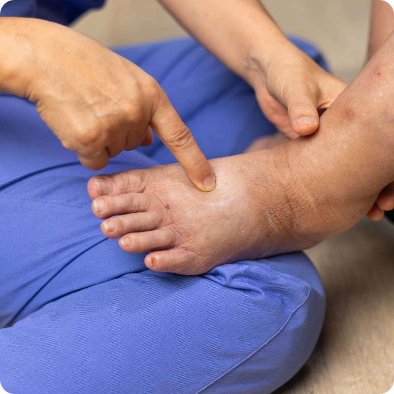 Wilson Health Paris Facebook ad: Paris Foot Care Services | Corns, Callus Wart Removal