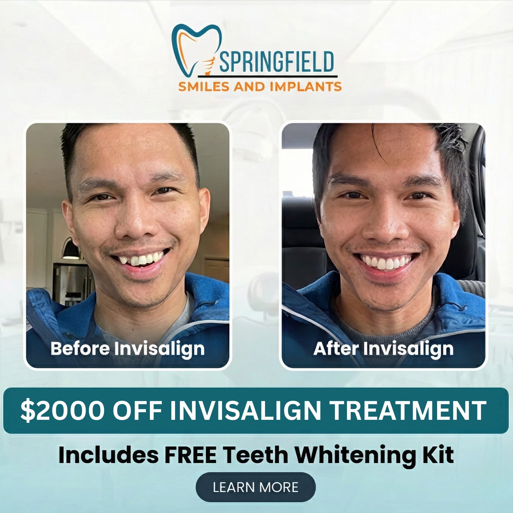 Springfield Smiles & Implants Facebook ad: Get $2,000 OFF Invisalign New Year Special, Limited Time…
