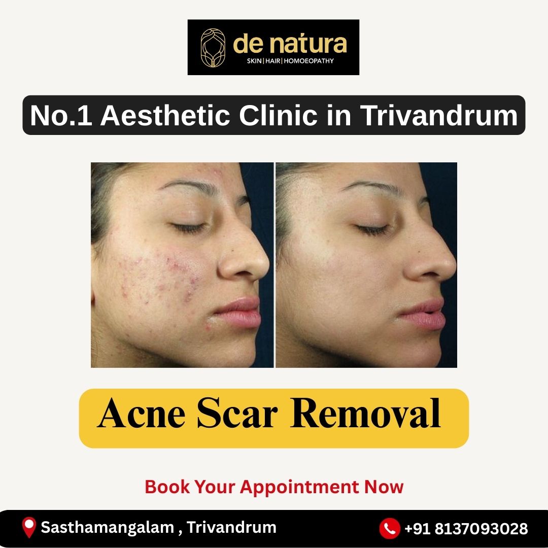 De Natura Aesthetics Facebook ad: Advanced Acne & Acne Scar Treatment