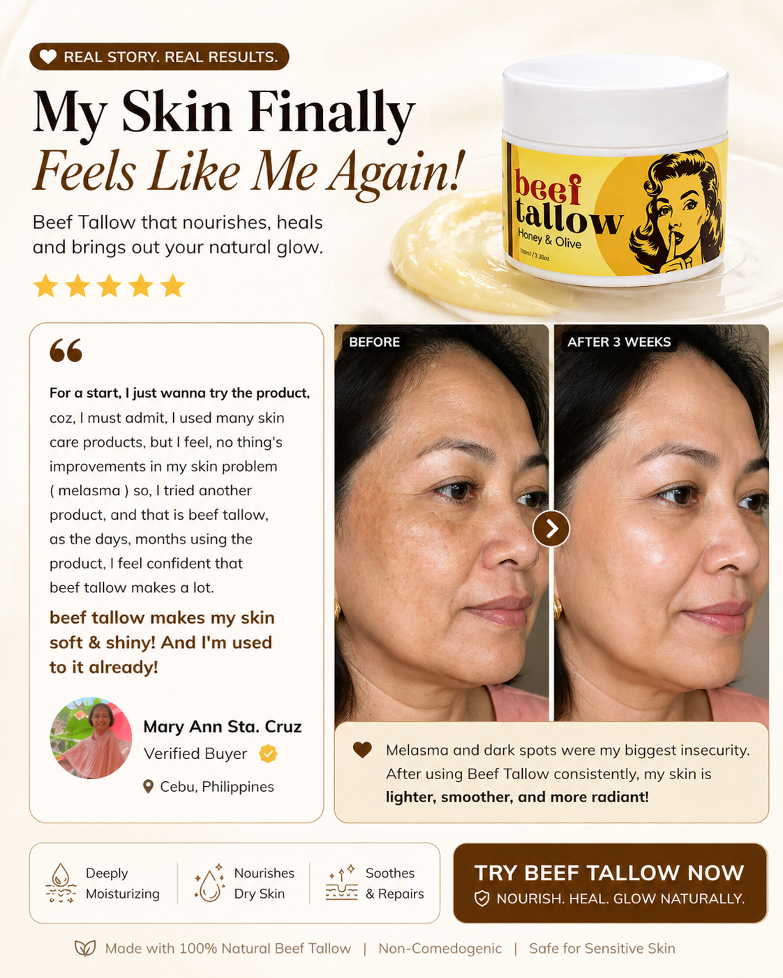 Premium Beef Tallow Facebook ad: My Melasma Didn’t Need More Products… It Needed This