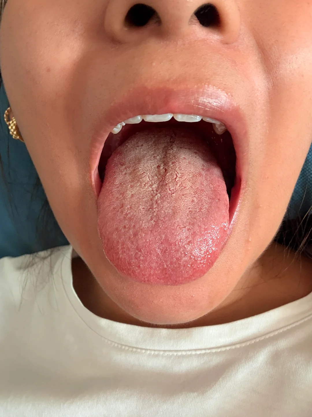 Veluna probiotics Facebook ad: Si alguna vez te pasó esto, probablemente no eres la única