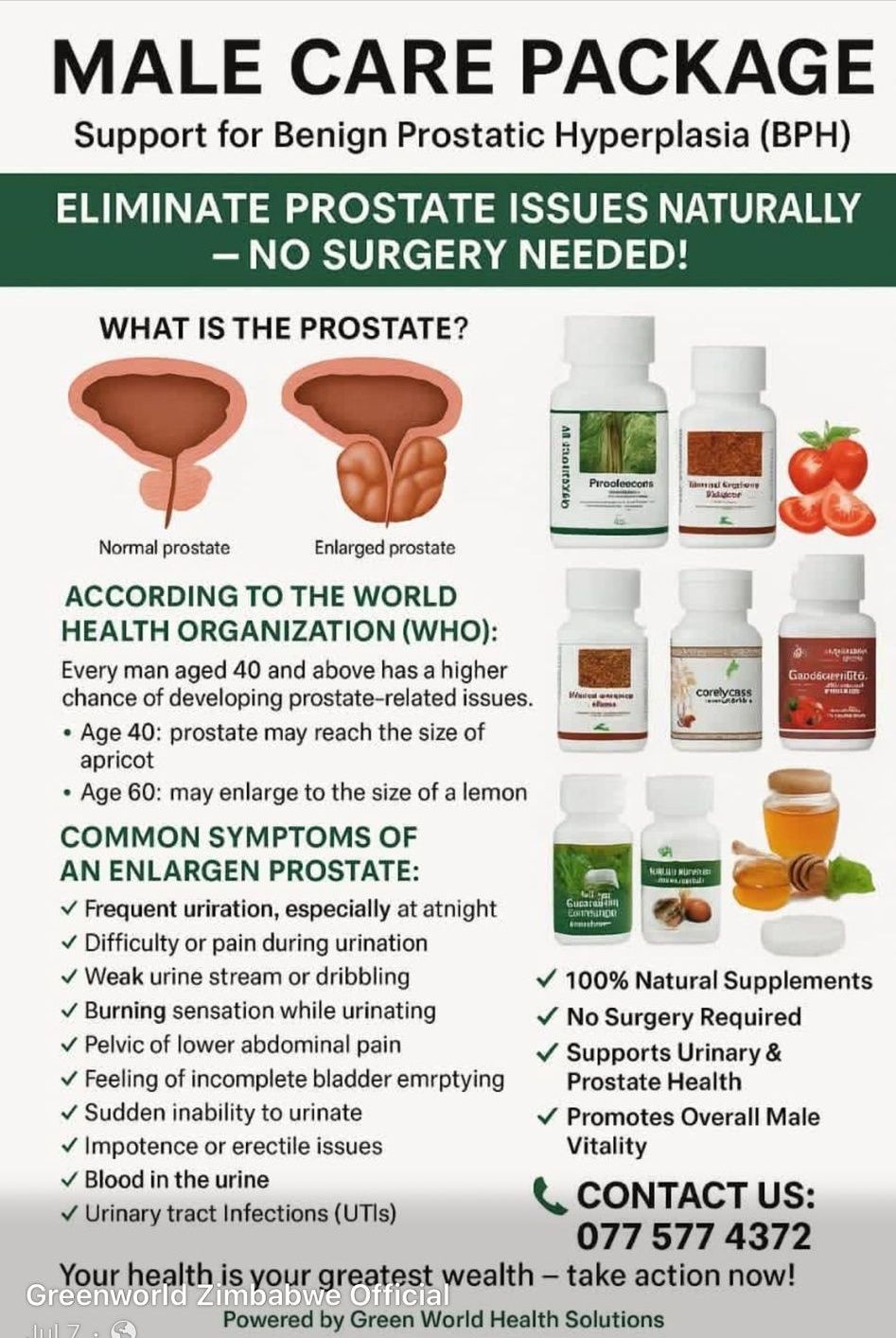 Greenworld Zimbabwe Official Facebook ad