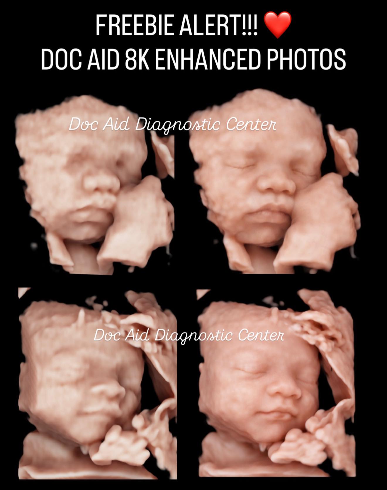 DOC AID Diagnostic Center - Molino Bacoor Cavite Facebook ad