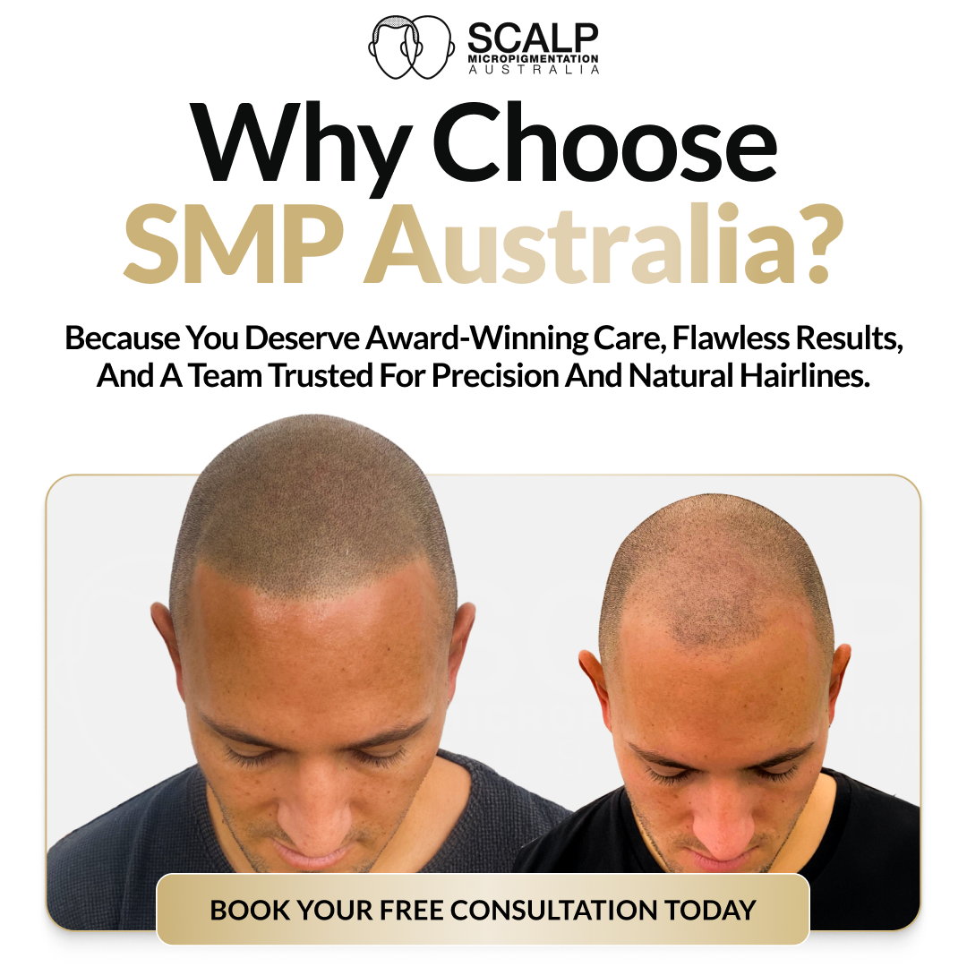 Scalp MicroPigmentation Australia Facebook ad