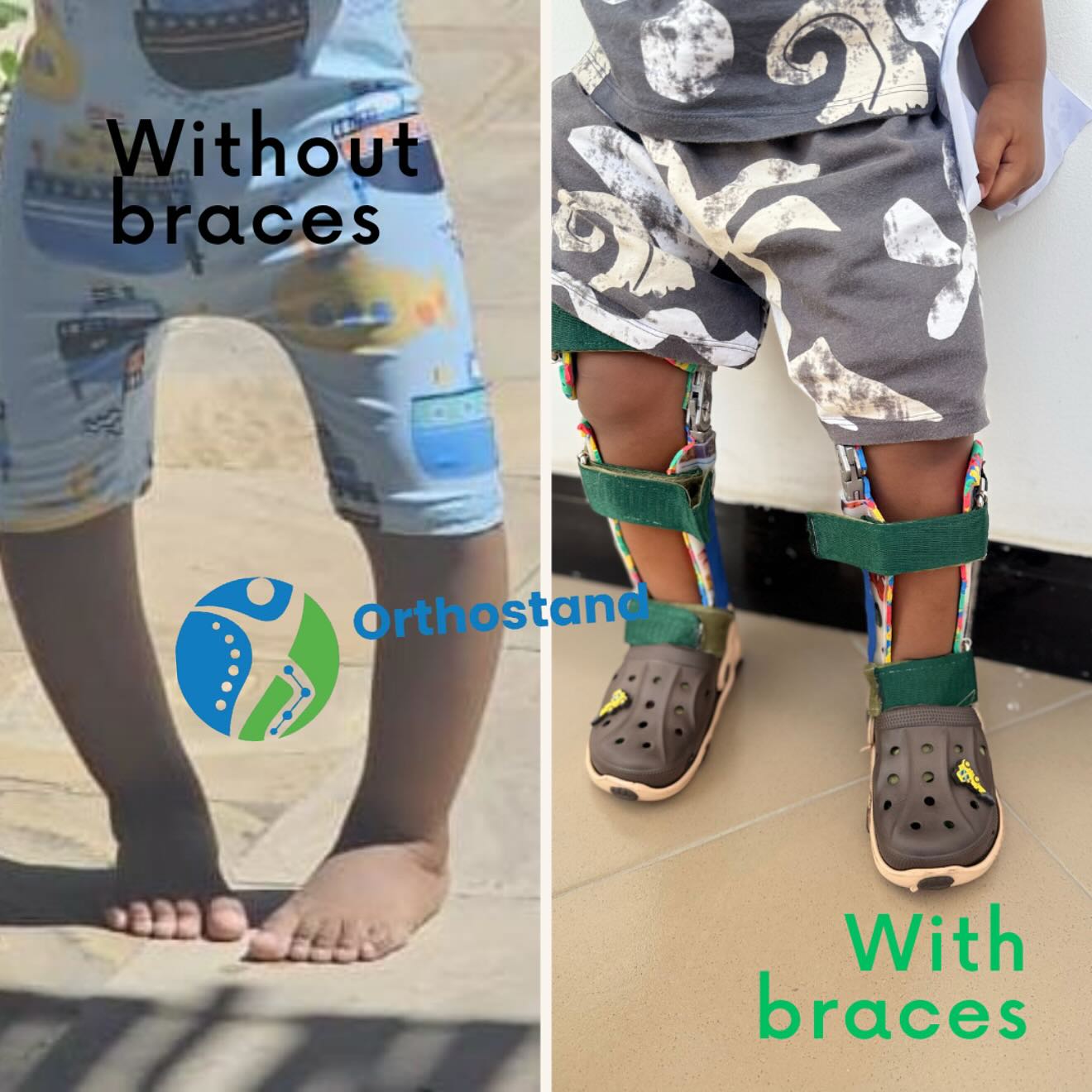 Orthostand mobility solution Facebook ad: MATEGE YANATIBIKA