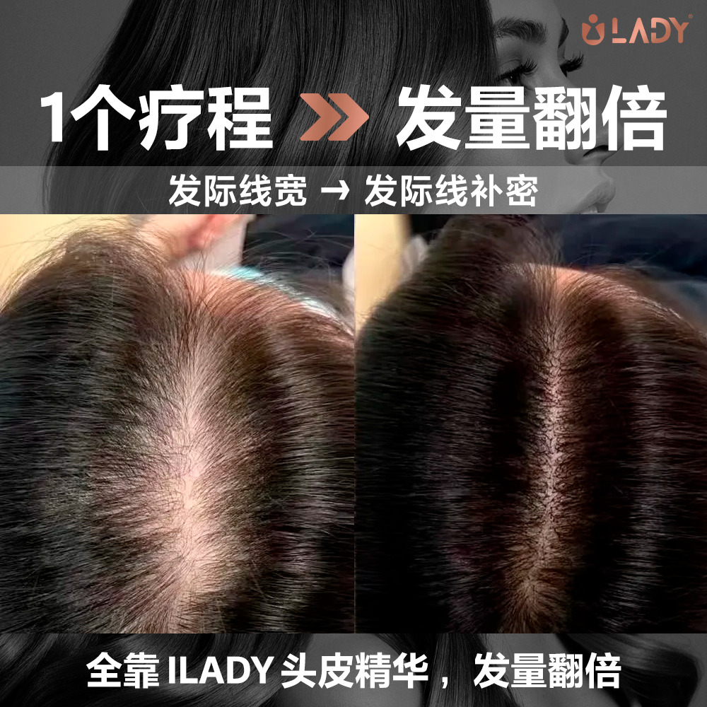 ILady 厚发量 Facebook ad