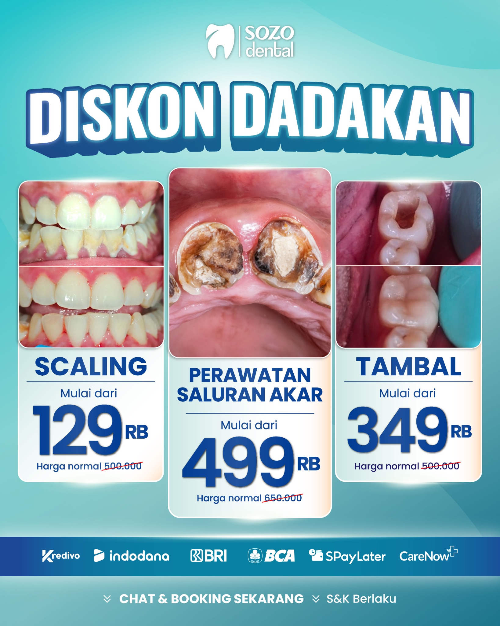 Sozo Dental Clinic Facebook ad