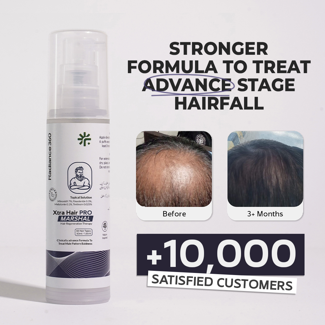 Radiance360 Facebook ad