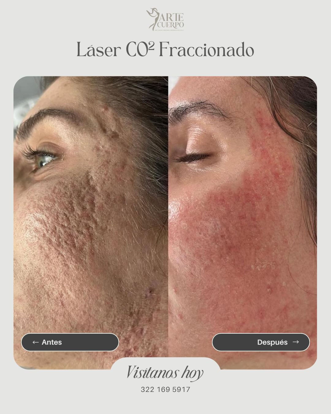 Clinica spa arte cuerpo  Facebook ad