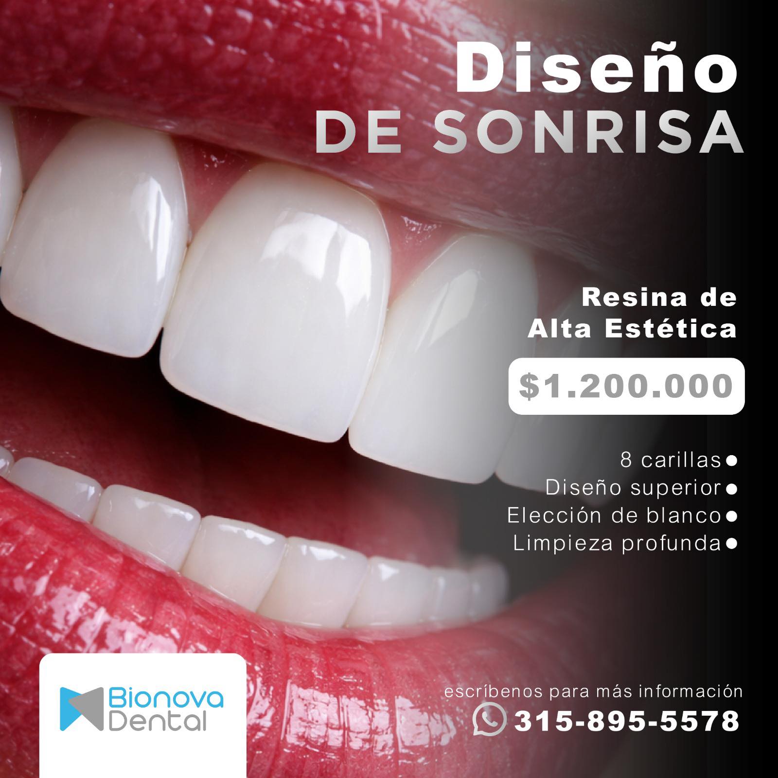Bionova Dental Facebook ad: EN RIONEGRO Los mejores Diseños de Sonrisa