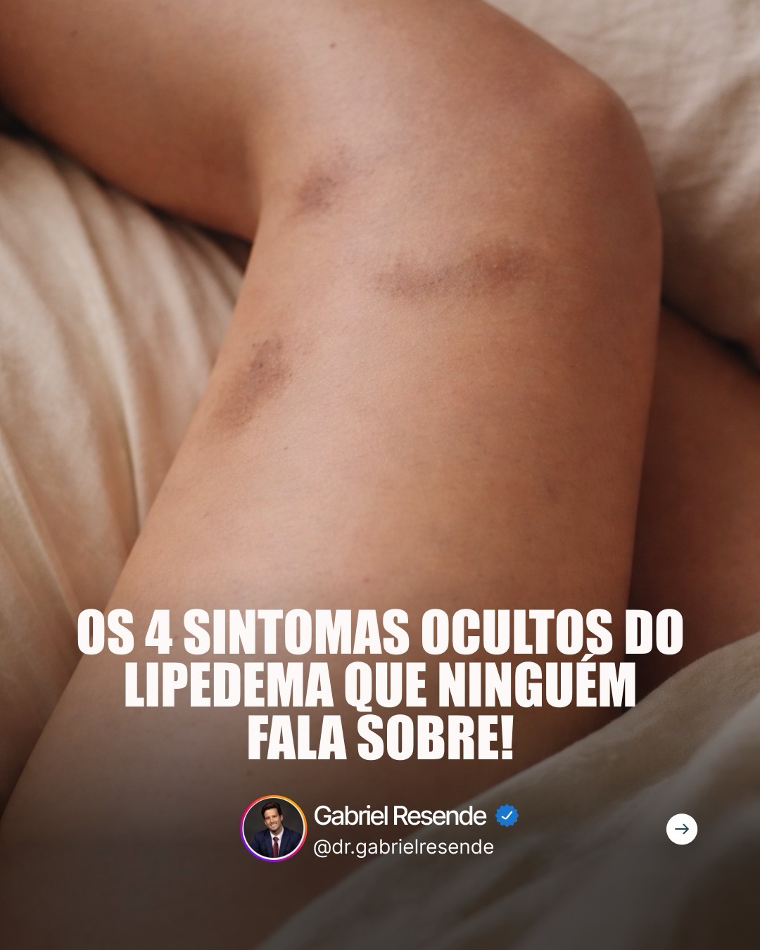 Dr. Gabriel Resende - Emagrecimento Facebook ad: Tem coisa que você sente… mas ninguém nunca…