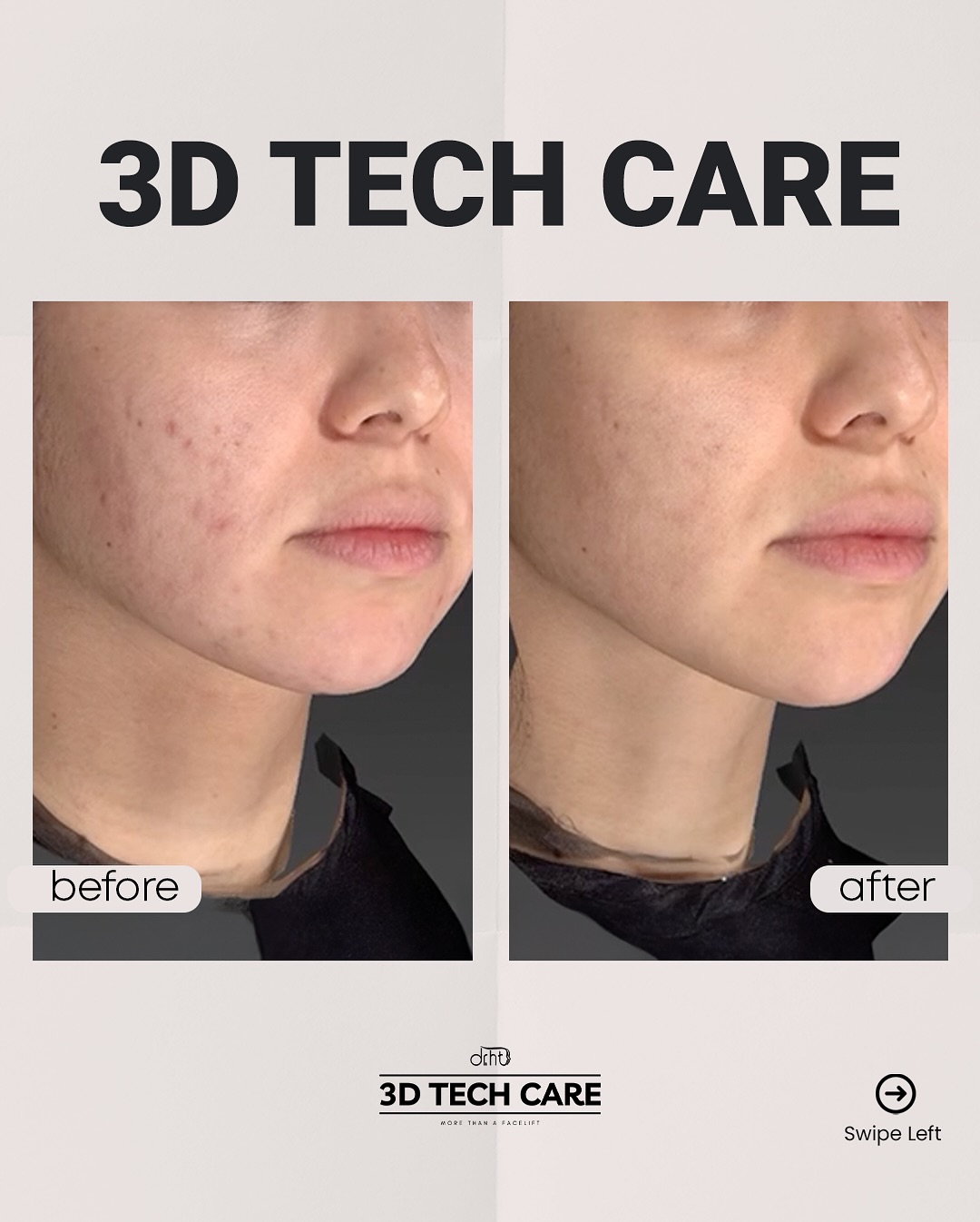 Dr. Hüseyin Tırman - Medical Aesthetic Facebook ad