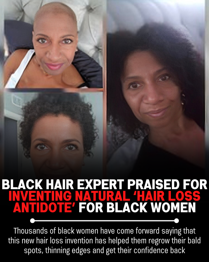 Black Hair Growth Remedy Facebook ad