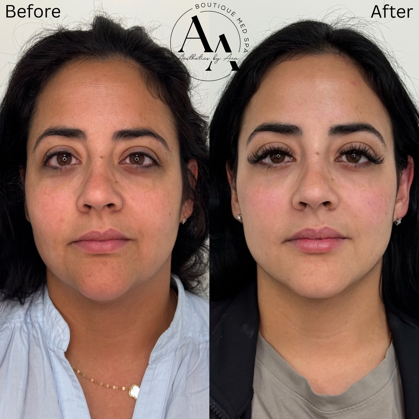 Aesthetics by Ana Facebook ad: Consistency is where the magic happens