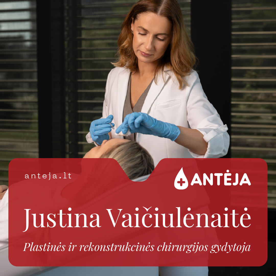 Antėja Facebook ad