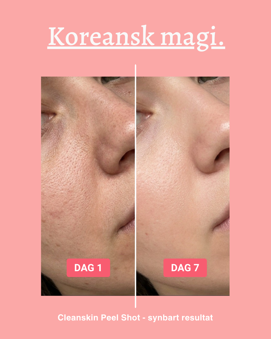 Cleanskin Store Facebook ad: Känn dig bekväm med din hud igen