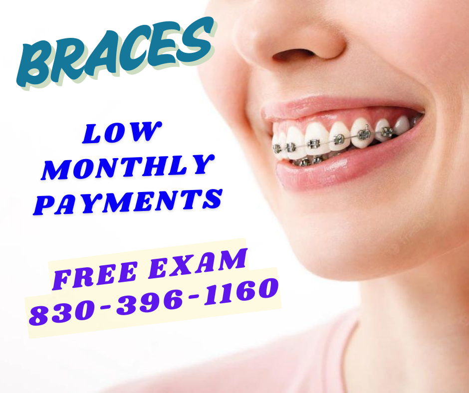 Affordable Dentist of Kenedy Facebook ad from Apr 21, 2025