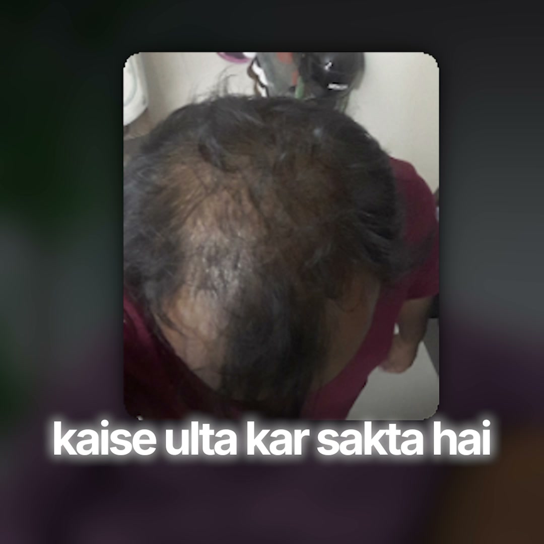 Traya Facebook ad: Chosen by 20L+ Indians
