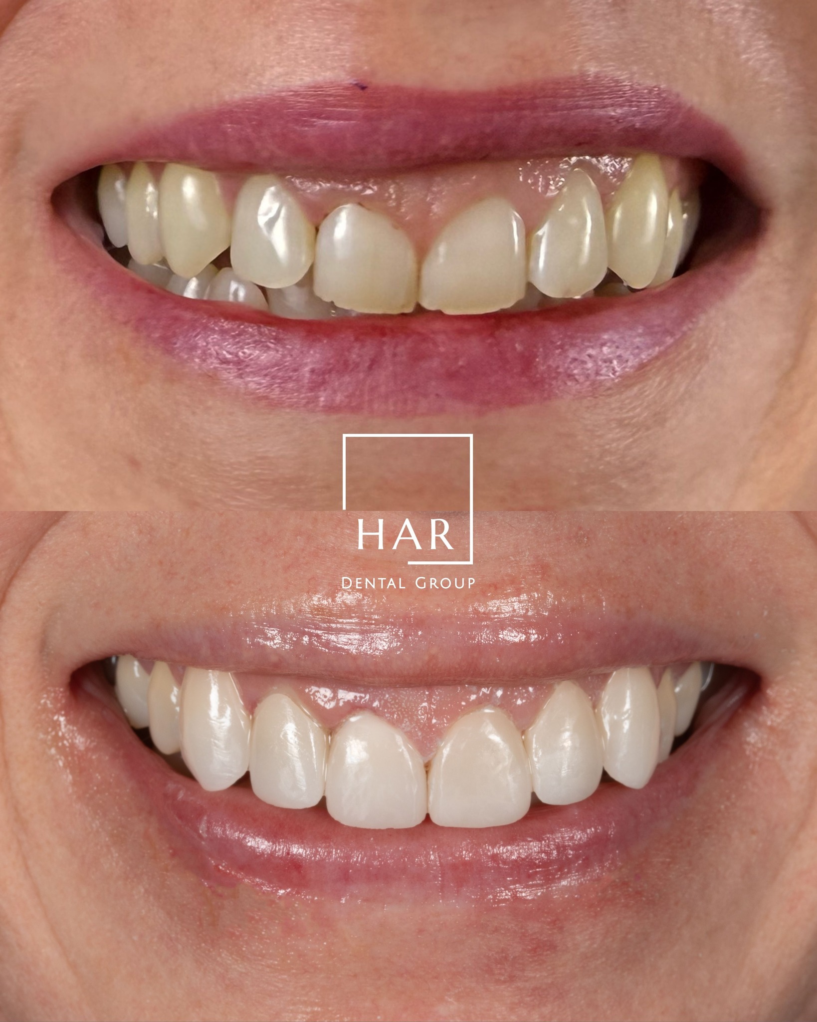 HAR Dental Facebook ad