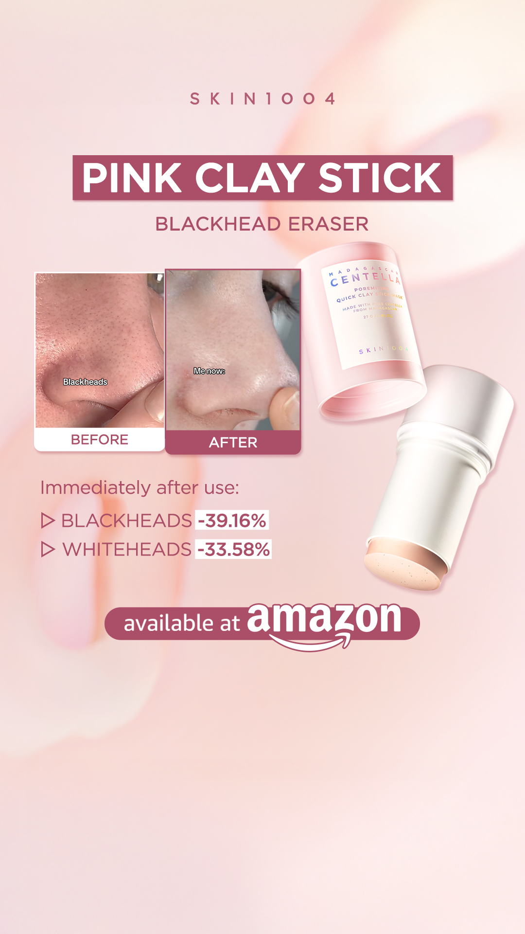 SKIN1004 Facebook ad