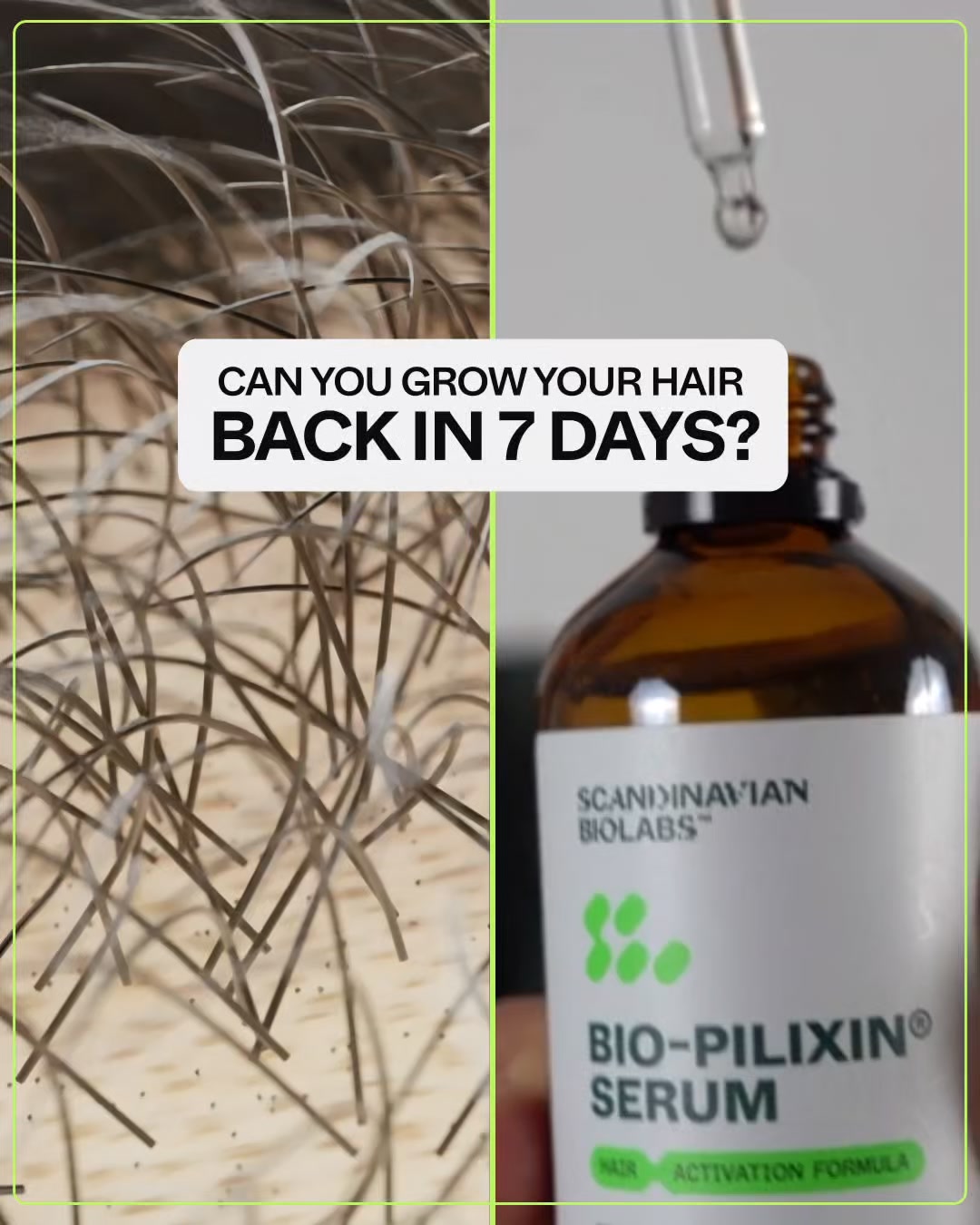 Scandinavian Biolabs Facebook ad: Science-based hair growth solution