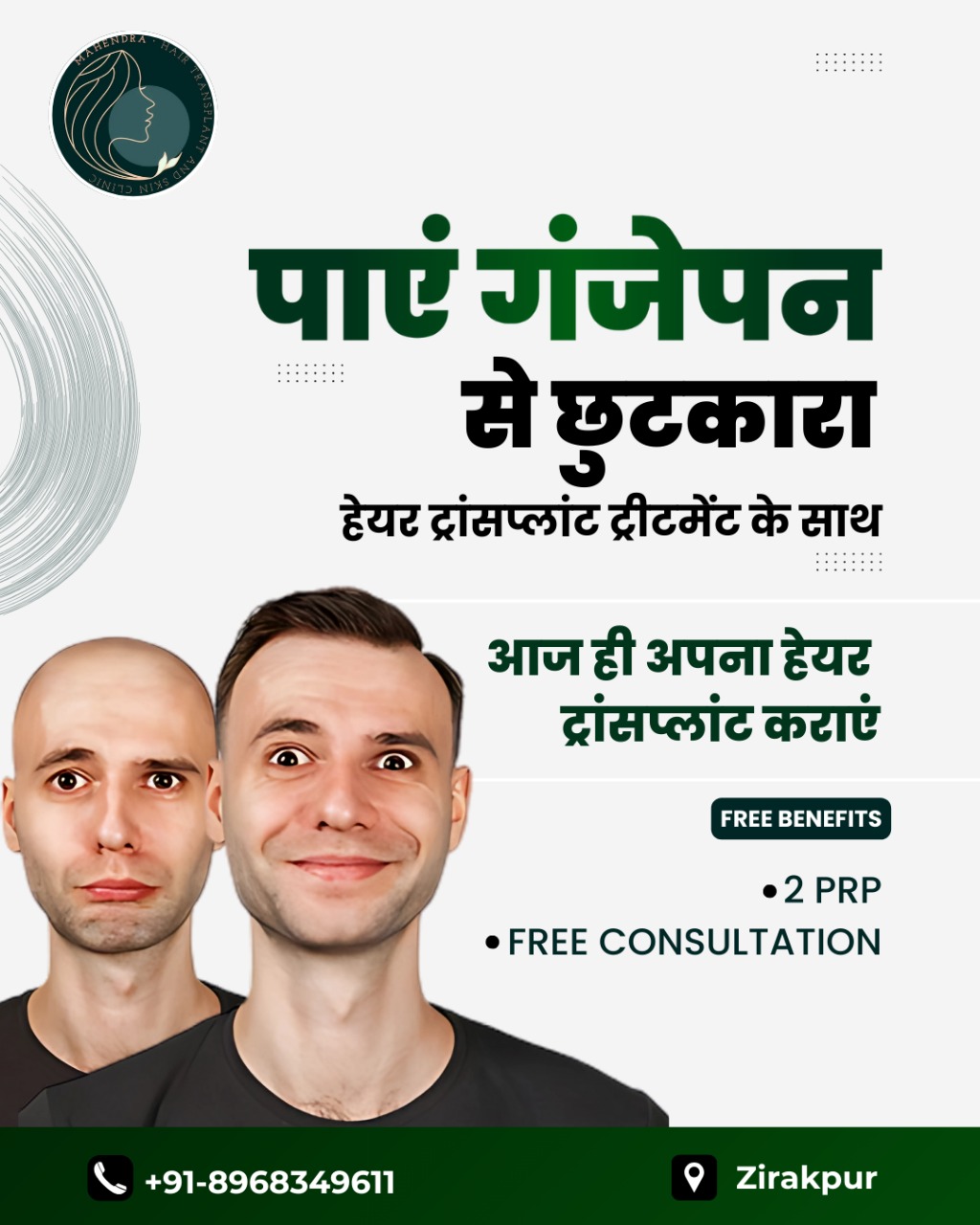 Mahendra Hair Transplant & Skin Clinic Facebook ad
