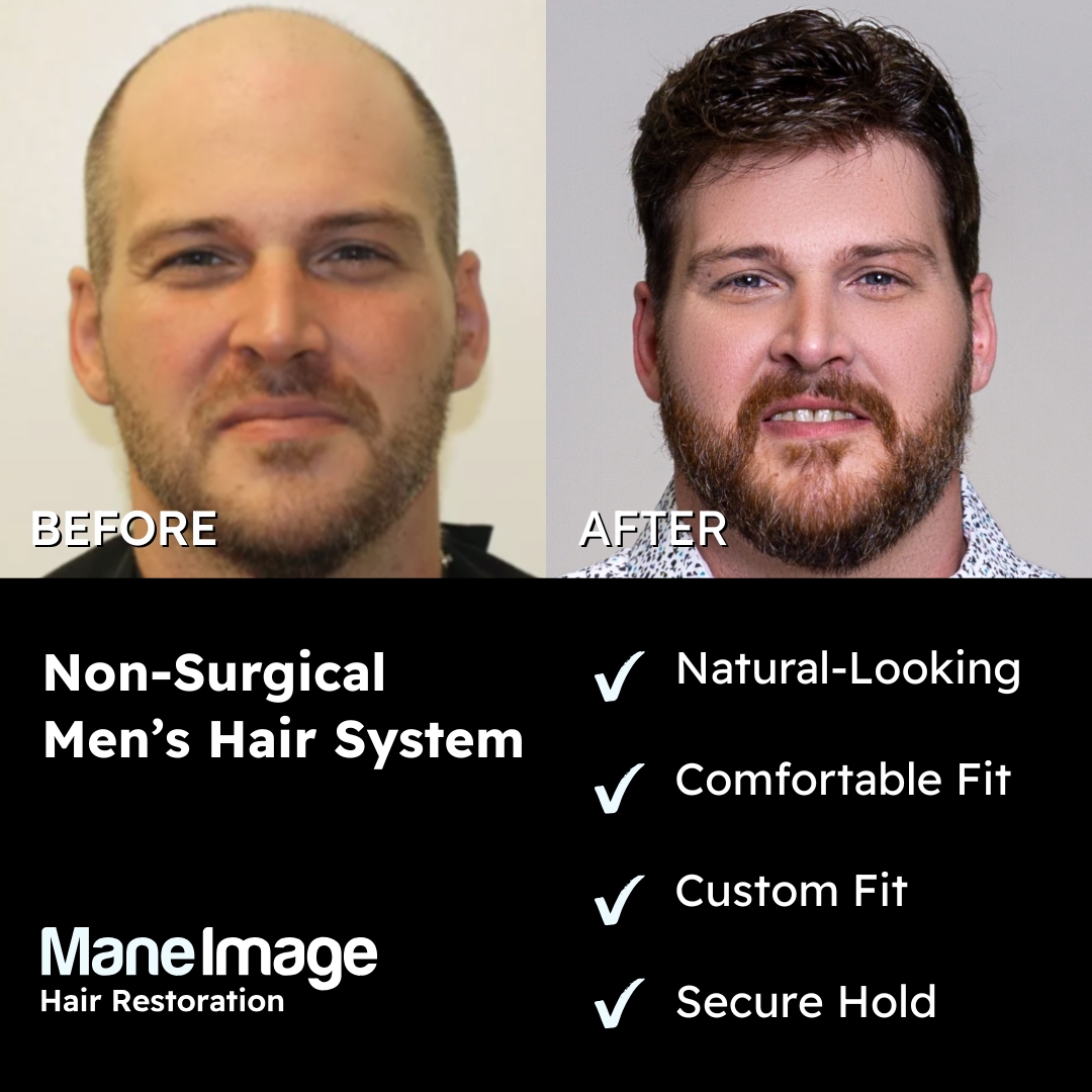 Mane Image Hair Replacement Center Facebook ad: Men’s Hair Restoration