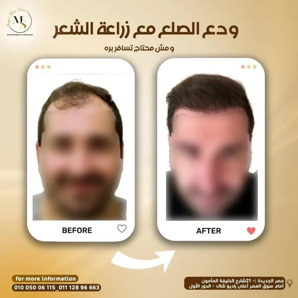 Magic skin clinics Facebook ad