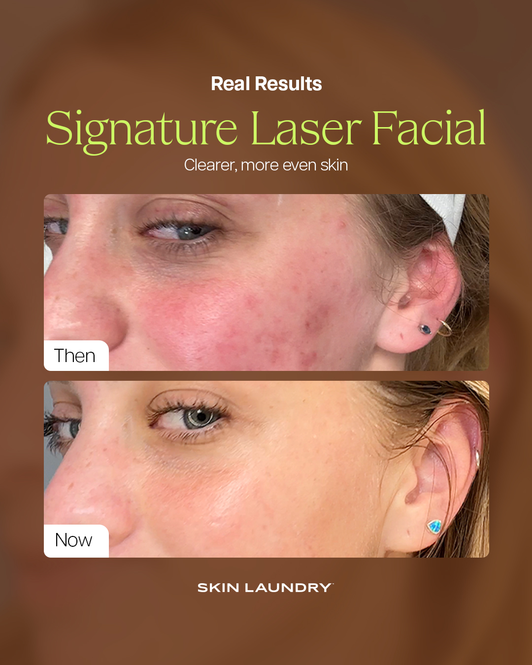 Skin Laundry Facebook ad