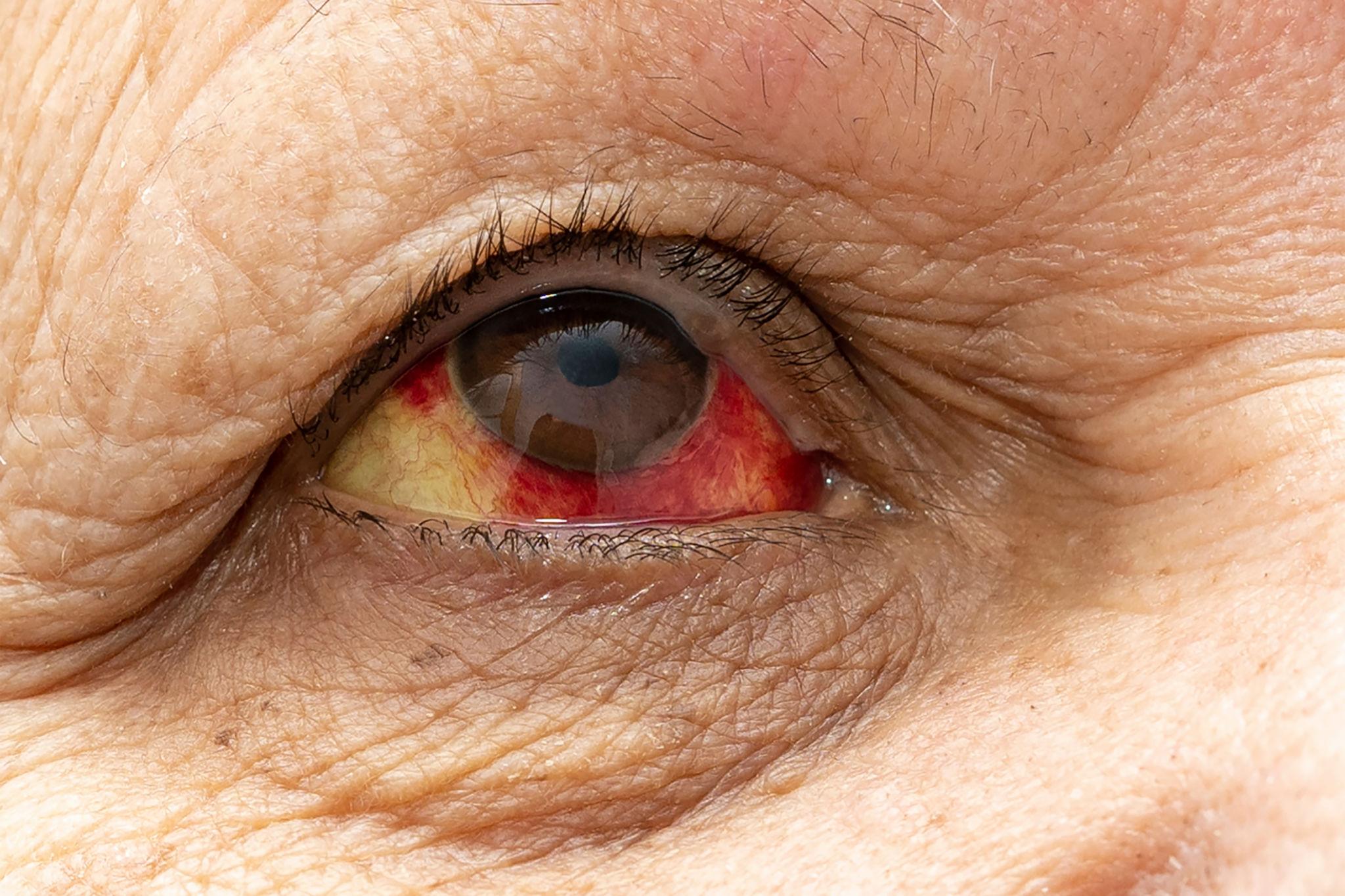 Liam Berg Facebook ad: Click here and stop Diabetic Retinopathy tomorrow
