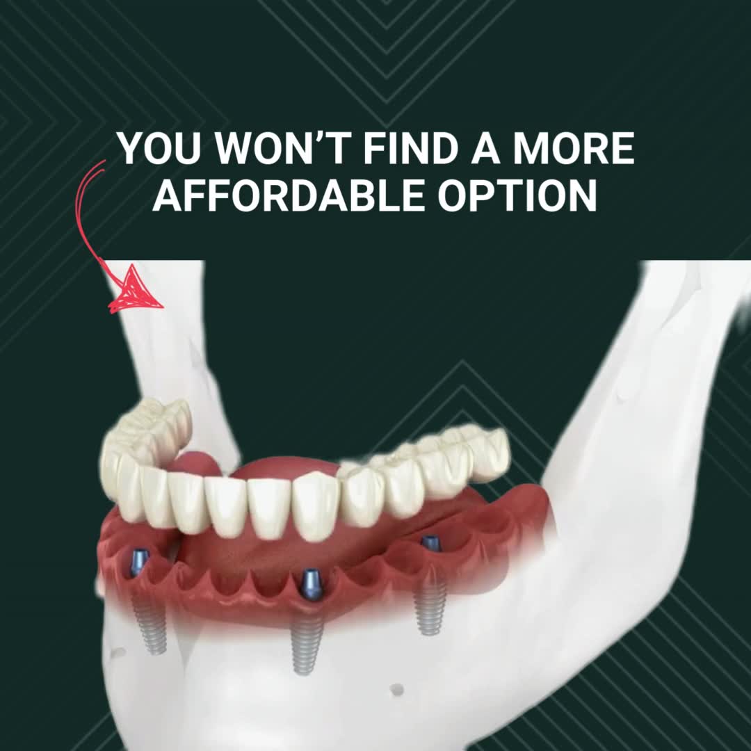 Exo Dental - Rogers Facebook ad: New Teeth. One Day.