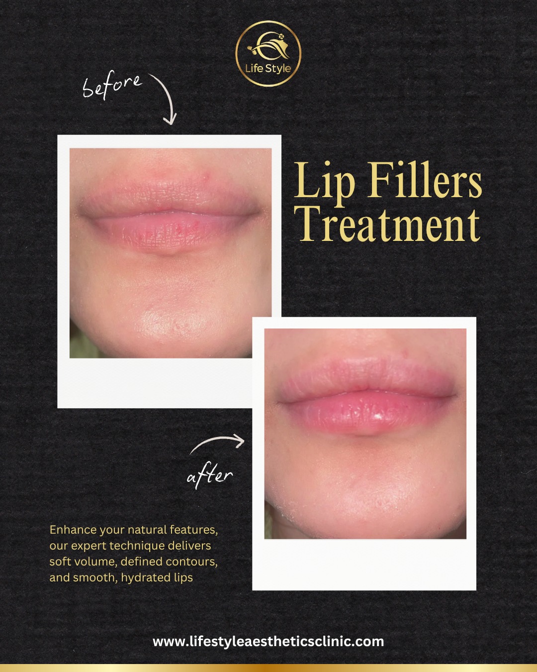 Lifestyle Aesthetics Clinic Gulshan Facebook ad: Results That Speak for Themselves
