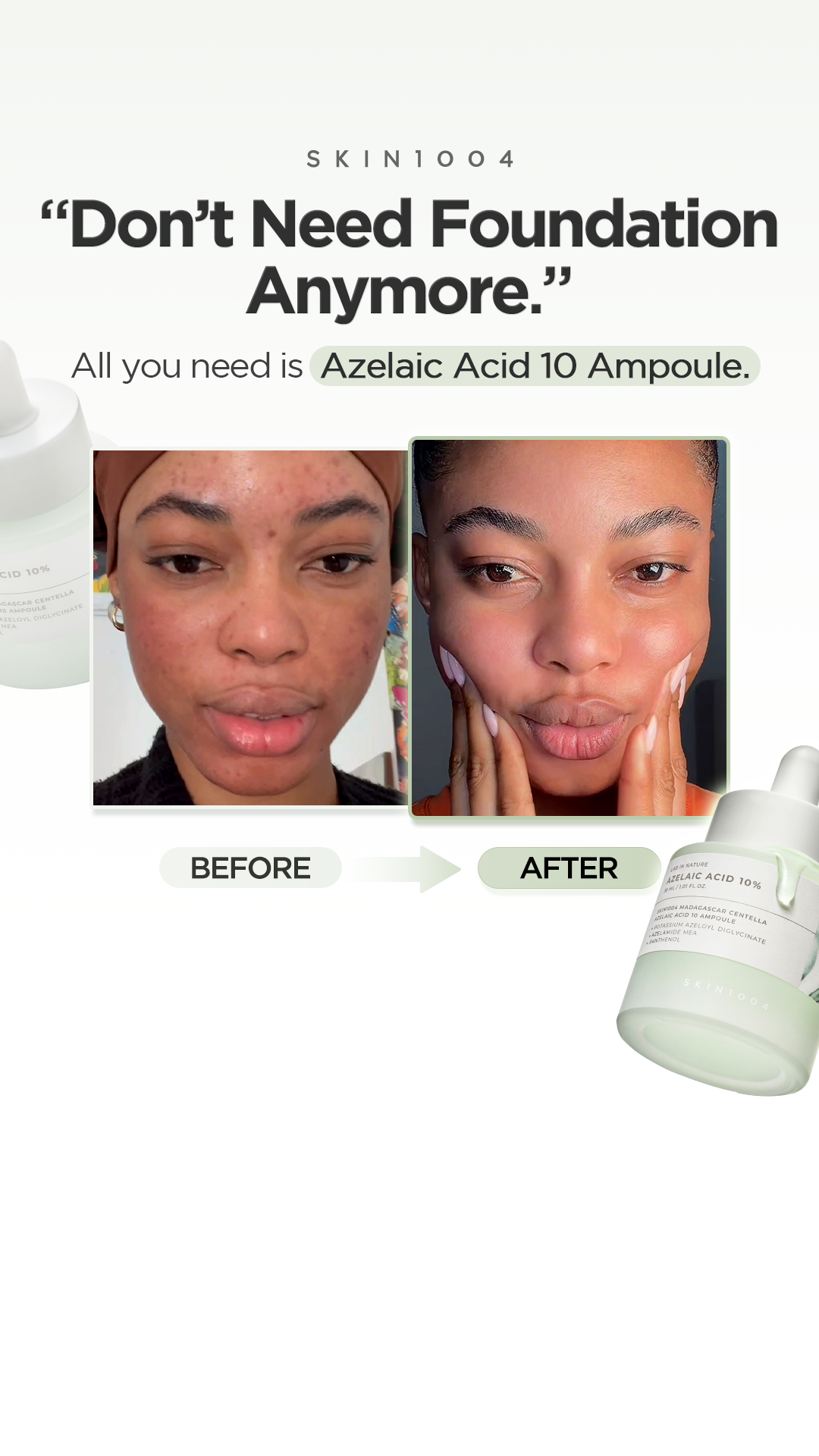 SKIN1004 Facebook ad