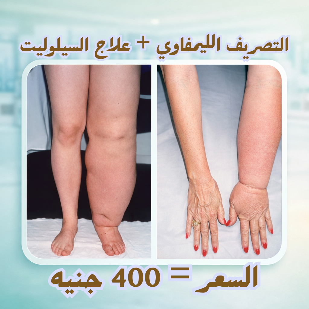 RAN Clinics Facebook ad