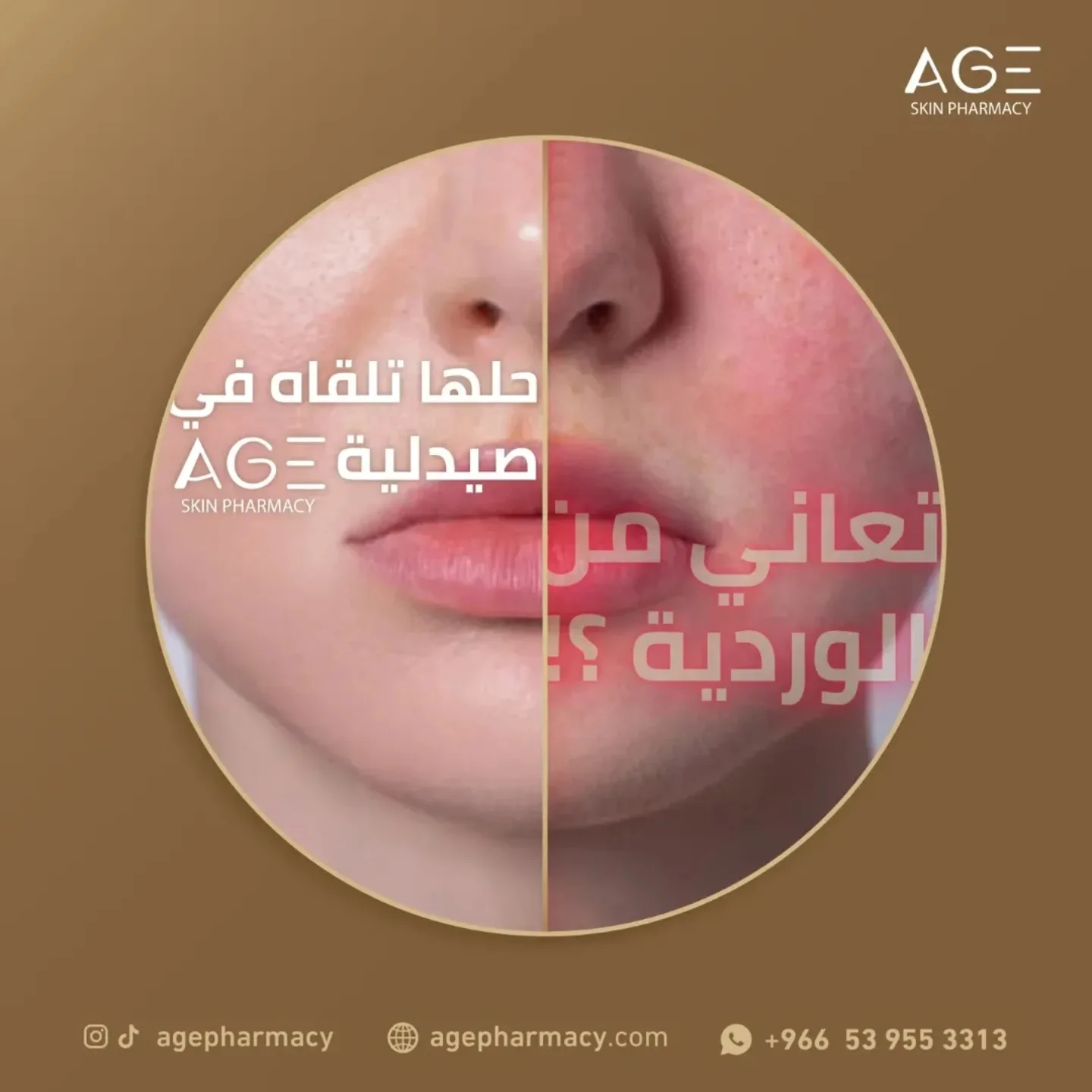 Skin AGE pharmacy- صيدلية عمر البشرة Facebook ad: Age Pharmacy