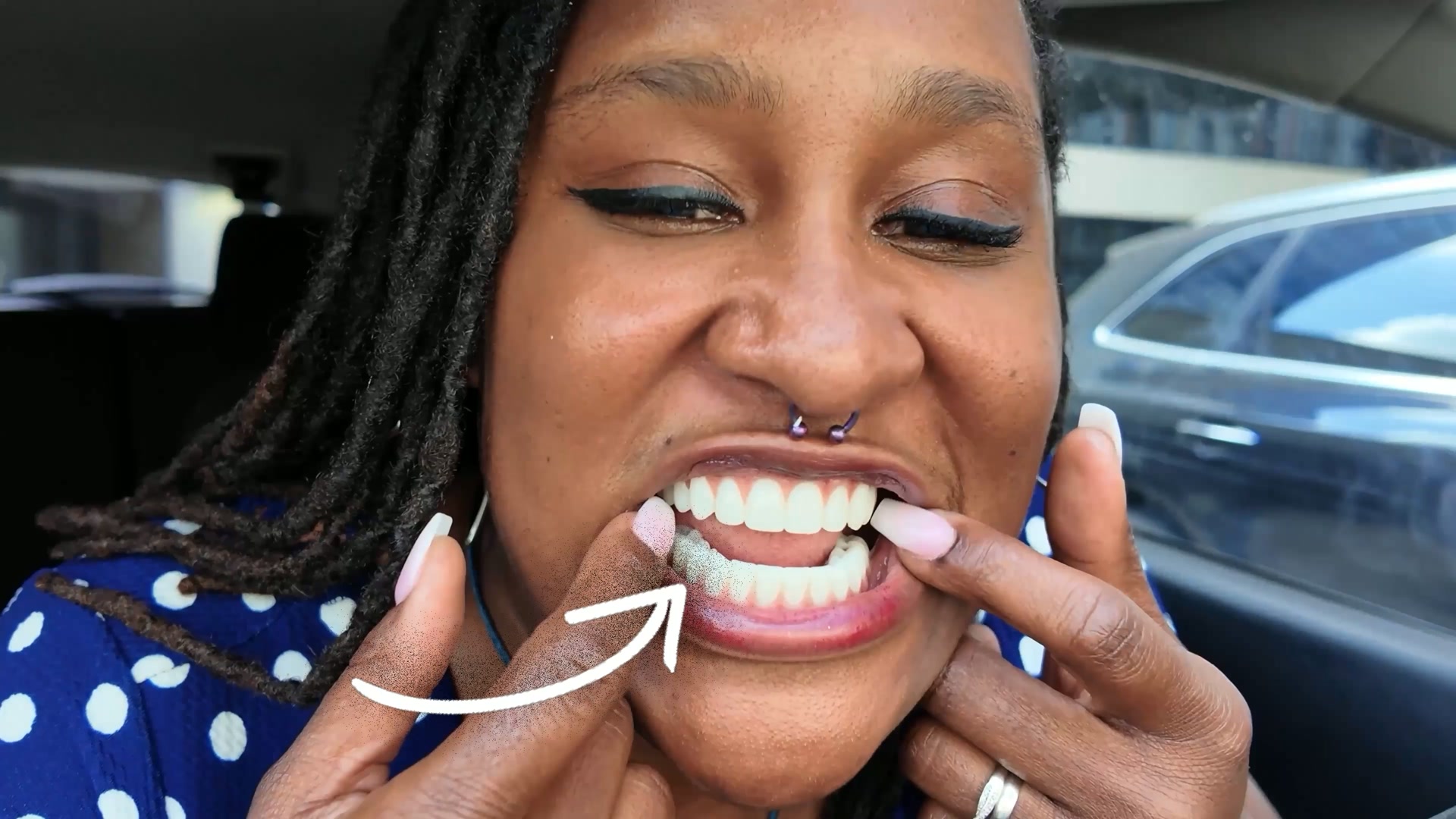Nuvia Dental Implant Center Facebook ad: The Ultimate Guide To Dental Implant Prices