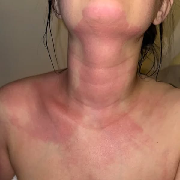 Caroline Wells Facebook ad: The part of your thyroid problem no blood test looks at