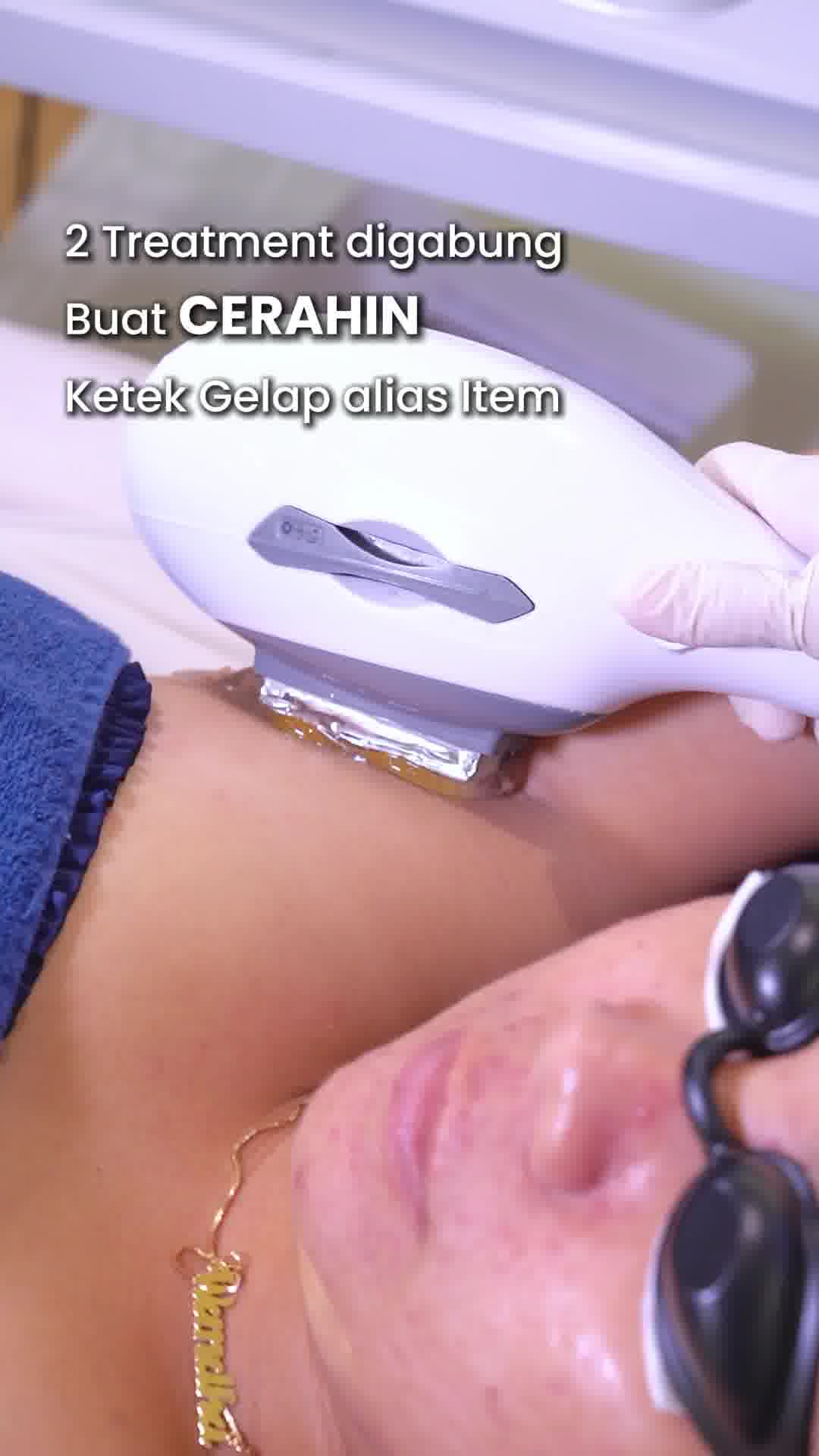 Sozo Skin Clinic Facebook ad: Coba treatment Botox