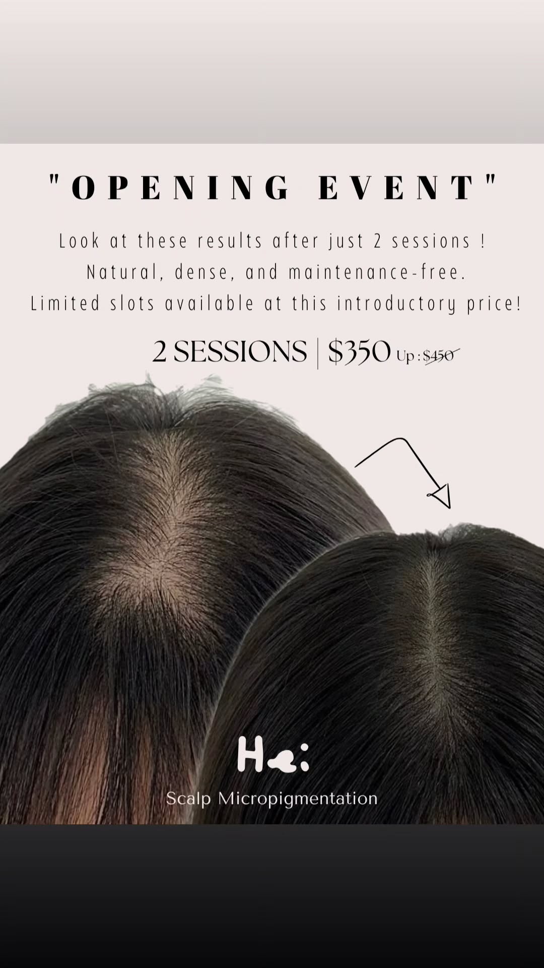 hei.smp Facebook ad from Mar 9, 2026