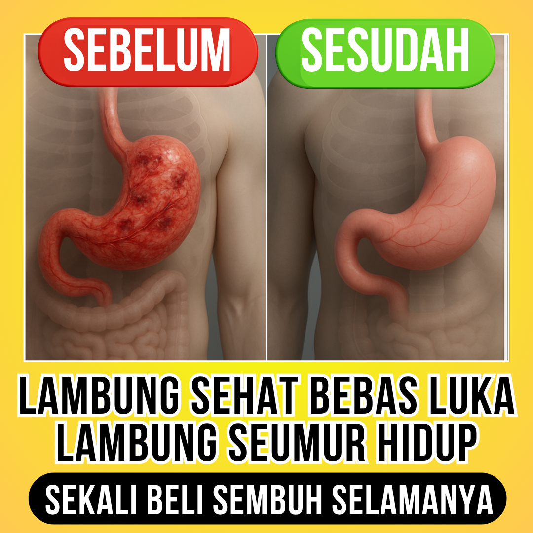 Axekafit Sahabat Lambung Facebook ad