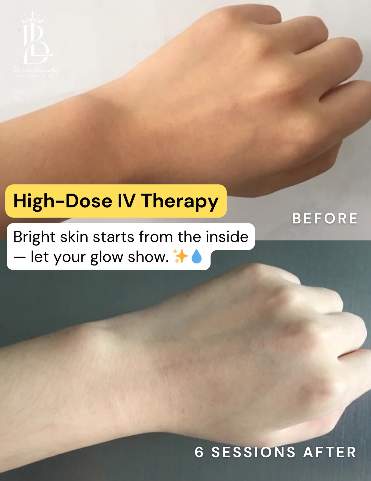 mybellaskin Facebook ad: Think of High-Dose IV Therapy as your skin’s…
