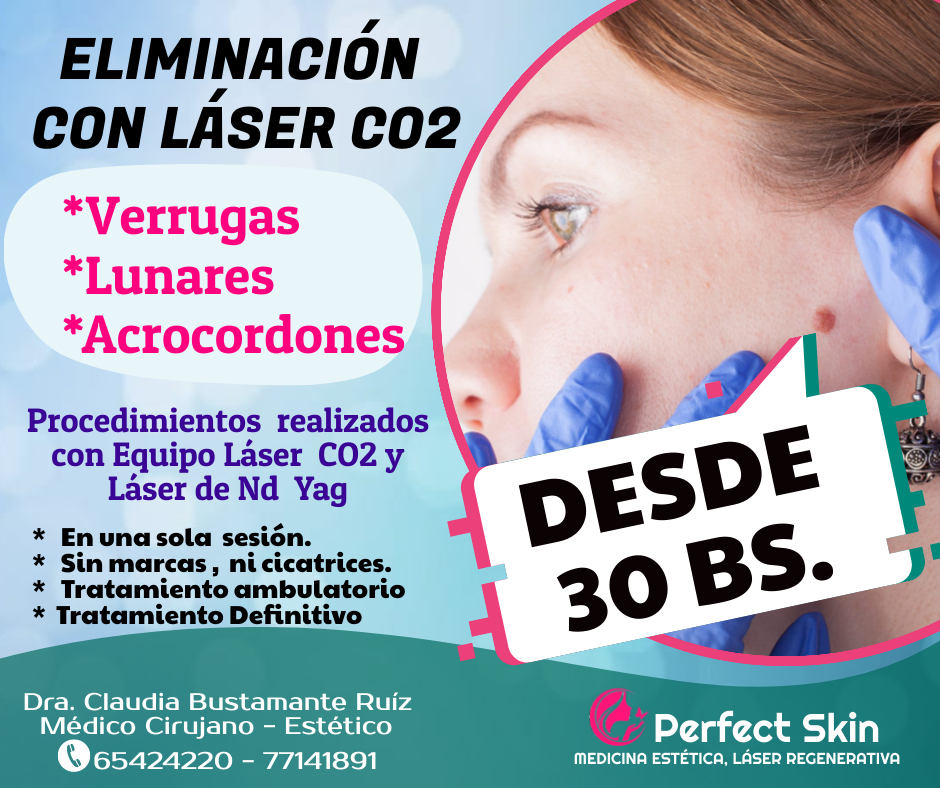 Perfect Skin Facebook ad: ELIMINACION DE LUNARES, VERRUGAS, ACROCORDONES CON LASER…