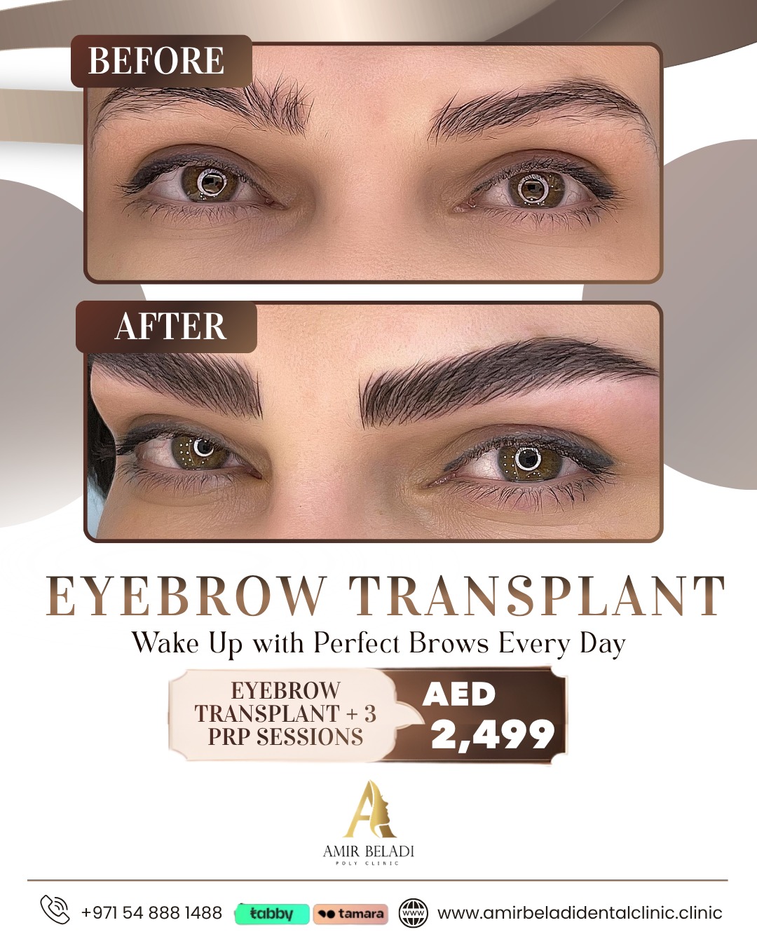 Amir Beladi Polyclinic Facebook ad: From Thin to Full. Permanently.